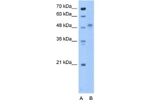 WB Suggested Anti-ZP4 Antibody Titration:  0. (ZP4 抗体  (N-Term))