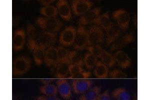 Immunofluorescence analysis of HeLa cells using RPL23A Polyclonal Antibody at dilution of 1:100. (RPL23A 抗体)