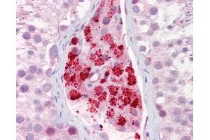 Anti-AURKA / Aurora-A antibody IHC of human testis. (Aurora A 抗体  (AA 100-150))