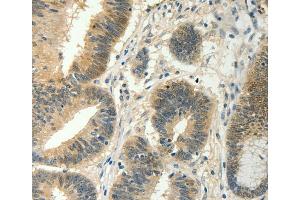 Immunohistochemistry (IHC) image for anti-Suppressor of Cytokine Signaling 5 (SOCS5) antibody (ABIN2428731) (SOCS5 抗体)