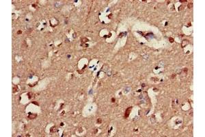 Immunohistochemistry of paraffin-embedded human brain tissue using ABIN7153479 at dilution of 1:100 (GABRA2 抗体  (AA 29-251))