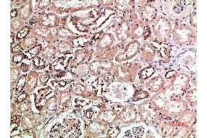 Immunohistochemical analysis of paraffin-embedded human-kidney, antibody was diluted at 1:200 (KIR2DL5A 抗体  (AA 121-170))