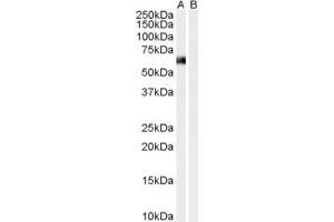 Western Blotting (WB) image for anti-Syntrophin, alpha 1 (Dystrophin-Associated Protein A1, 59kDa, Acidic Component) (SNTA1) (N-Term) antibody (ABIN2465307) (SNTA1 抗体  (N-Term))
