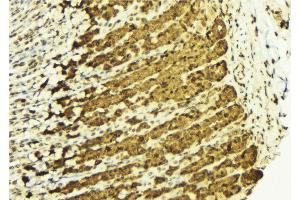 ABIN6269050 at 1/100 staining Human gastric tissue by IHC-P. (IKK alpha 抗体  (N-Term))
