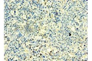 Immunohistochemistry of paraffin-embedded human thyroid tissue using ABIN7171313 at dilution of 1:100 (T-Box 22 抗体  (AA 291-520))