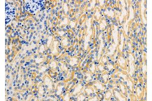 ABIN6259791 and ABIN6266850 at 1/100 staining Mouse kidney tissue by IHC-P. (ADCK1 抗体  (Internal Region))