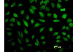 Immunofluorescence of monoclonal antibody to THRAP5 on HeLa cell. (MED16 抗体  (AA 1-110))
