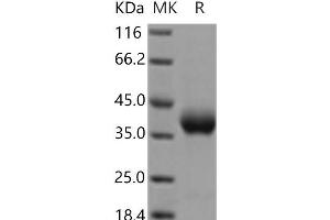 Western Blotting (WB) image for Prolactin Receptor (PRLR) protein (His tag) (ABIN7321228)