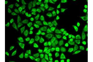 Immunofluorescence analysis of HeLa cell using IL7R antibody. (IL7R 抗体  (AA 21-239))