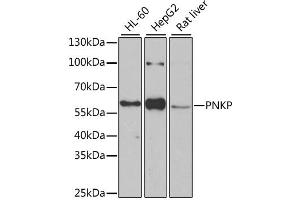 Western blot analysis of extracts of various cell lines, using PNKP antibody (ABIN2564598) at 1:1000 dilution. (PNKP 抗体)