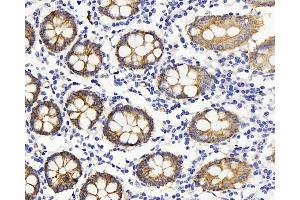 Immunohistochemistry analysis of paraffin-embedded human colon using Claudin 5 Polyclonal Antibody at dilution of 1:400. (Claudin 5 抗体)