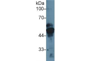 Western Blot; Sample: Human MCF7 cell lysate; Primary Ab: 1µg/ml Rabbit Anti-Rat KRT17 Antibody Second Ab: 0. (KRT17 抗体  (AA 84-392))