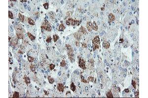 Immunohistochemical staining of paraffin-embedded Human liver tissue using anti-SDCBP mouse monoclonal antibody. (SDCBP 抗体)