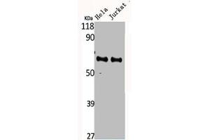 CYP4F2 抗体  (N-Term)