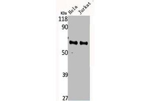 Western Blot analysis of HELA Jurkat cells using CYP4F2 Polyclonal Antibody (CYP4F2 抗体  (N-Term))