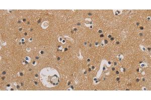 Immunohistochemistry of paraffin-embedded Human brain tissue using ITGB3BP Polyclonal Antibody at dilution 1:50 (ITGB3BP 抗体)