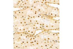 Immunohistochemistry (Paraffin-embedded Sections) (IHC (p)) image for anti-Hairy and Enhancer of Split 3 (HES3) antibody (ABIN7074159)