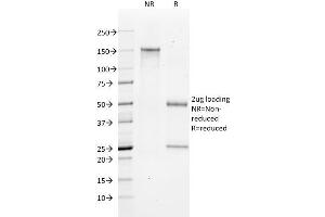 SDS-PAGE Analysis Purified Bax Mouse Monoclonal Antibody (2D2).