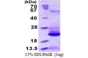 Biogenesis of Lysosomal Organelles Complex-1, Subunit 2 (BLOC1S2) protein (His tag)