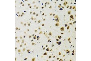 Immunohistochemistry (Paraffin-embedded Sections) (IHC (p)) image for anti-RuvB-Like 2 (E. Coli) (RUVBL2) (AA 1-463) antibody (ABIN6147322)