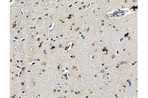 ABIN7096723 and ABIN7100788 at 1/100 staining rat brain tissue by IHC-P. (EXOSC6 抗体)
