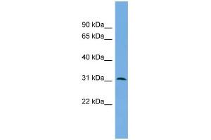 WB Suggested Anti-DAPP1 Antibody Titration: 0. (DAPP1 抗体  (Middle Region))