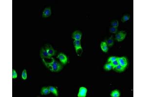 Immunofluorescent analysis of A431 cells using ABIN7144394 at dilution of 1:100 and Alexa Fluor 488-congugated AffiniPure Goat Anti-Rabbit IgG(H+L) (Apelin Receptor 抗体  (AA 309-380))