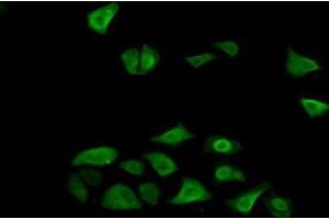 Detection of FN3K in Human Hela Cells using Polyclonal Antibody to Fructosamine-3-Kinase (FN3K) (FN3K 抗体  (AA 1-309))