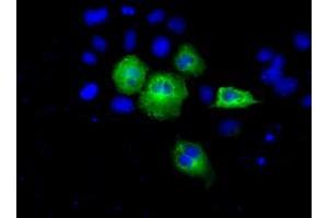 Image no. 2 for anti-Acetyl-CoA Acetyltransferase 2 (ACAT2) antibody (ABIN1496403) (ACAT2 抗体)