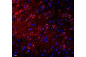 Immunofluorescence of paraffin embedded mouse brain using NECAB1 (ABIN7074753) at dilution of 1: 2300 (400x lens) (NECAB1 抗体)