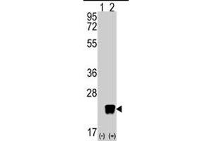 Western blot analysis of ARL3 (arrow) using rabbit ARL3 polyclonal antibody . (ARL3 抗体  (C-Term))