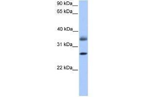 LGALS8 antibody used at 1 ug/ml to detect target protein. (LGALS8 抗体)