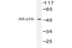 Image no. 1 for anti-Adrenoceptor alpha 1A (ADRA1A) antibody (ABIN272286) (alpha 1 Adrenergic Receptor 抗体)