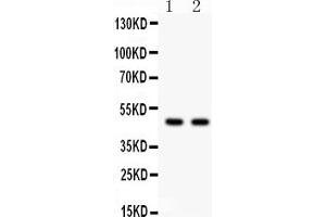 Anti-PTOV1 antibody, (ABIN3042495), Western blottingAll lanes: Anti PTOV1 (ABIN3042495) at 0.