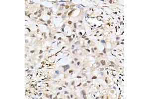 Immunohistochemistry (IHC) image for anti-Actin, alpha 2, Smooth Muscle, Aorta (ACTA2) (AA 1-124) antibody (ABIN6136473)