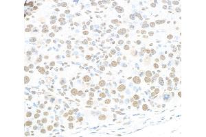 Immunohistochemistry (IHC) image for anti-RNA-binding protein Raly (RALY) (AA 256-306) antibody (ABIN7454547)