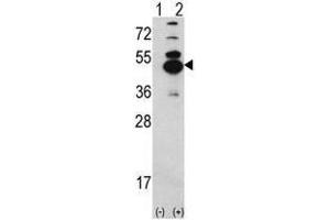 Image no. 1 for anti-Calcium/calmodulin-Dependent Protein Kinase ID (CAMK1D) (N-Term) antibody (ABIN452804) (CAMK1D 抗体  (N-Term))
