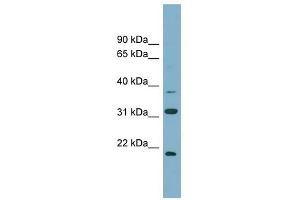 N6AMT1 antibody used at 1 ug/ml to detect target protein. (N6AMT1 抗体)