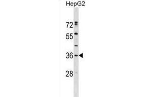 Western Blotting (WB) image for anti-Endoplasmic Reticulum Protein 27 (ERP27) antibody (ABIN2999524) (ERP27 抗体)