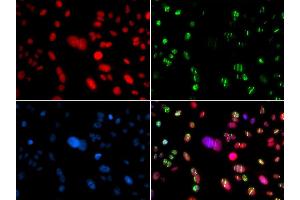 Immunofluorescence analysis of GFP-RNF168 transgenic U2OS cells using RAG2 antibody. (RAG2 抗体  (AA 258-527))