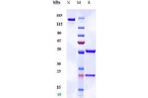 Anti-SIRPg / CD172g Reference Antibody (KWAR23) on SDS-PAGE under reducing (R) condition. (Recombinant SIRPG 抗体)