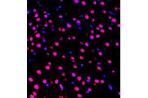 Immunofluorescence of paraffin embedded mouse brain using ZNF498 (ABIN7076253) at dilution of 1:650 (400x lens) (Zinc Finger and SCAN Domain Containing 25 (ZSCAN25) 抗体)