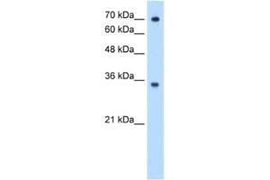Western Blotting (WB) image for anti-IgG receptor FcRn (FcRn) antibody (ABIN2462979) (FcRn 抗体)