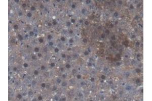 Immunohistochemistry (IHC) image for anti-Calcium/calmodulin-Dependent Protein Kinase II alpha (CAMK2A) (AA 1-478) antibody (ABIN7435484)