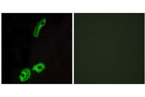 Immunofluorescence analysis of HeLa cells, using GPR151 antibody. (GPR151 抗体  (C-Term))