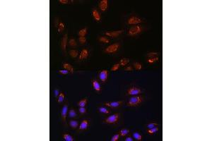 Immunofluorescence analysis of U-2 OS cells using RALGDS antibody (ABIN7269838) at dilution of 1:100. (RALGDS 抗体)