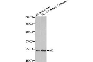 Western blot analysis of extracts of various cell lines, using AK1 antibody. (Adenylate Kinase 1 抗体)