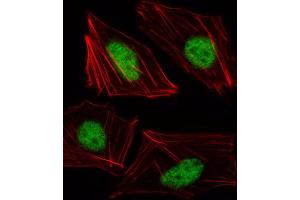 Immunofluorescence (IF) image for anti-T-Box 15 (TBX15) antibody (ABIN3000287) (T-Box 15 抗体)
