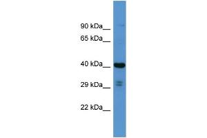 Host: Rabbit Target Name: SCAMP3 Sample Type: RPMI-8226 Whole cell lysates Antibody Dilution: 1. (SCAMP3 抗体  (N-Term))