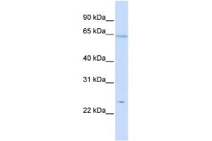WB Suggested Anti-PRDX2 Antibody Titration:  0. (Peroxiredoxin 2 抗体  (Middle Region))